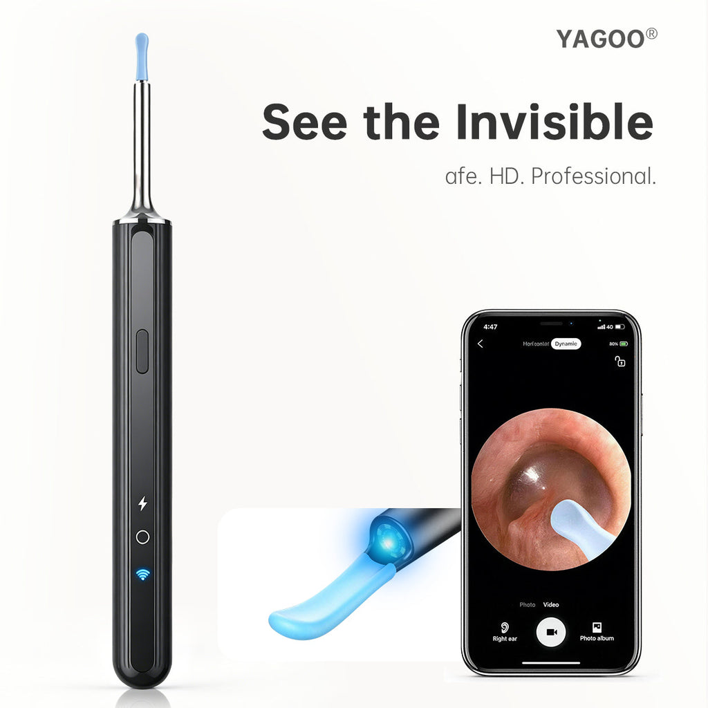 ClearView Home Ear Care Camera
