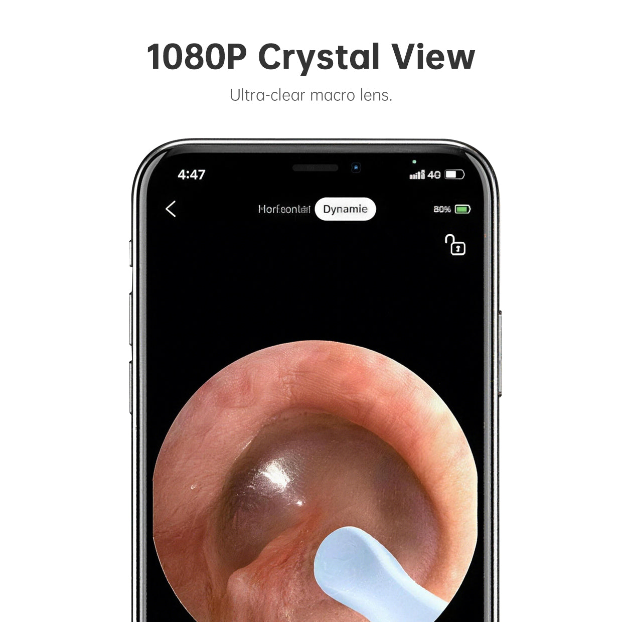 ClearView Home Ear Care Camera