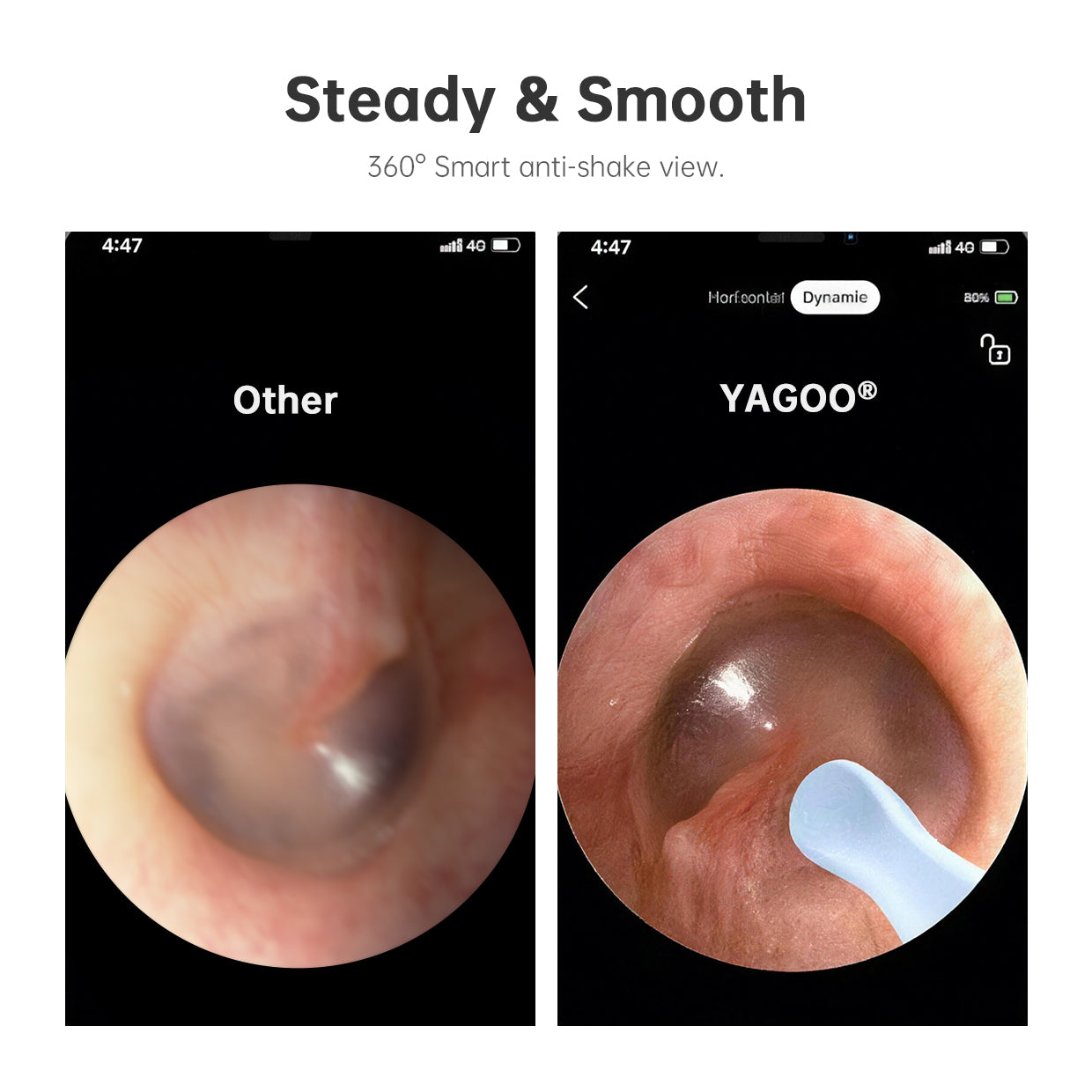 ClearView Home Ear Care Camera